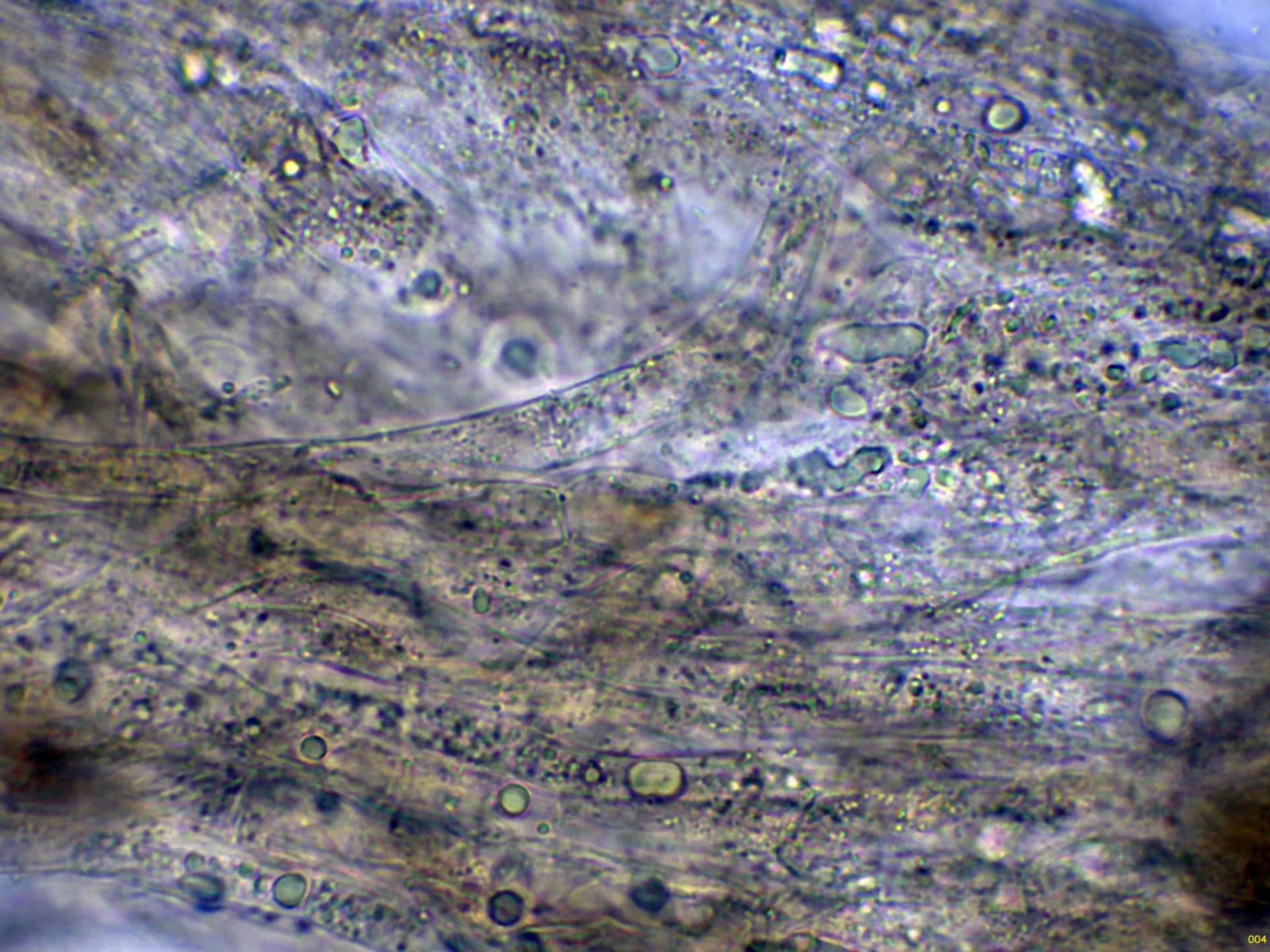 10 - Suprapellis agua-004